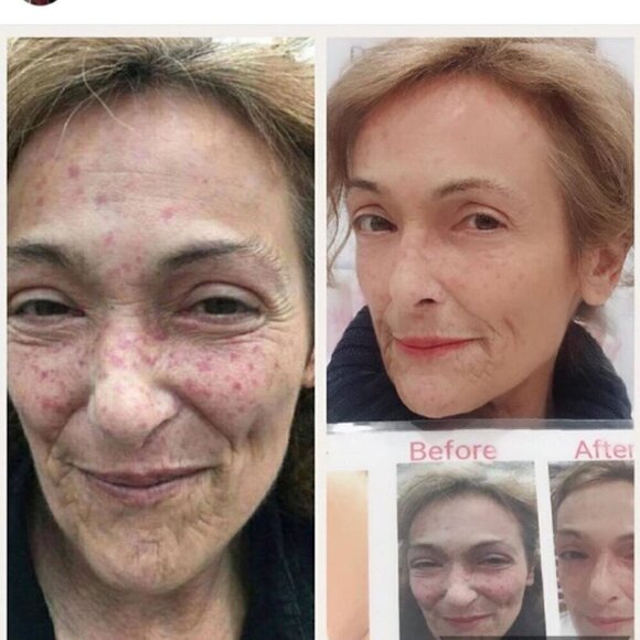 NEW! Infinite Aloe Everyday Hero Skincare Cream 8 OZ+ travel -Original Scent - Picture 13 of 14